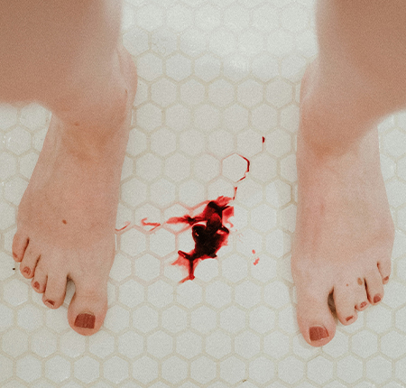 De ce apare menstruatia neregulata ➤ Simptome pentru menstruatie dereglata