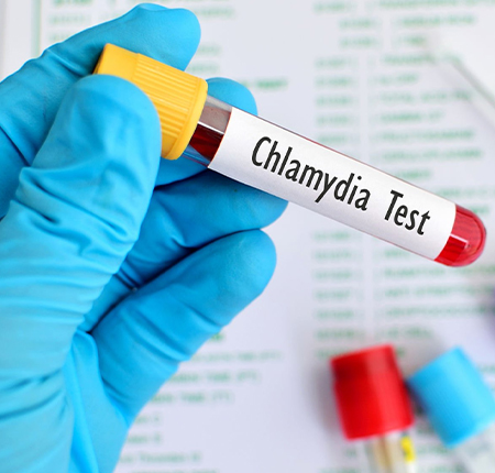 Totul despre infectia cu Chlamydia ➤ Ce este Chlamydia ➤ Cauze ➤ Simptome ➤ Tratament ➤ Afla cum poti preveni infectia cu Chlamydia! 